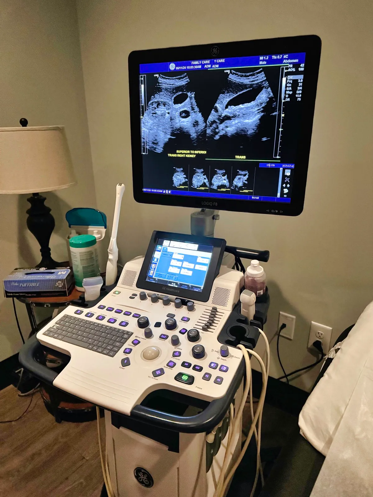 A modern medical ultrasound scanner